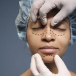 Rhinoplasty: 5 Tips Penting Sebelum Operasi Hidung Anda