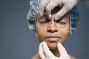 Rhinoplasty: 5 Tips Penting Sebelum Operasi Hidung Anda