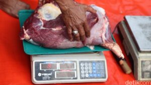 Waspadai Kolesterol Tinggi: Gejala Tersembunyi yang Perlu Anda Ketahui
